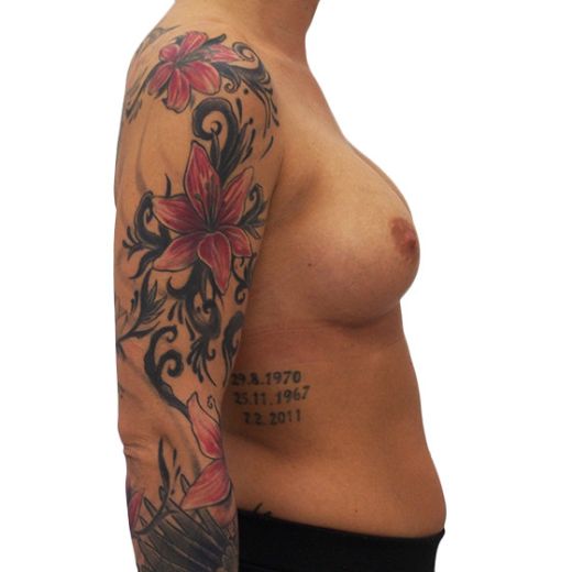 Image after