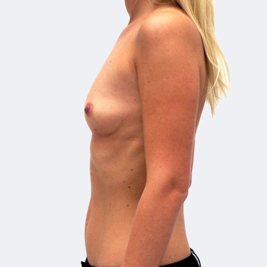 Image before
