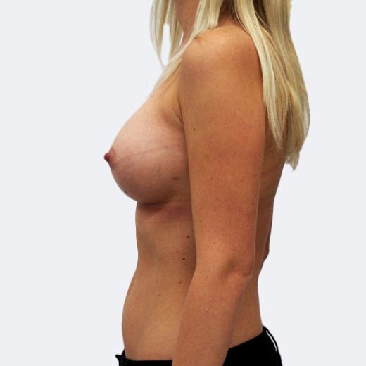 Image after