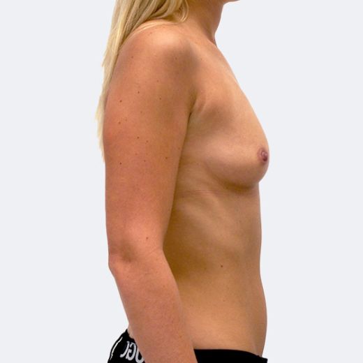 Image before