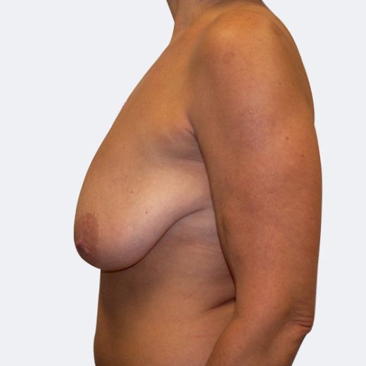 Image before