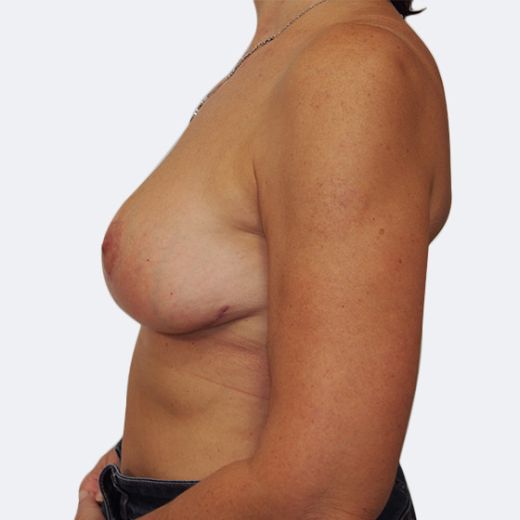 Image after