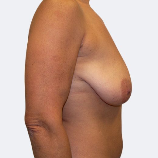 Image before