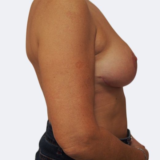Image after