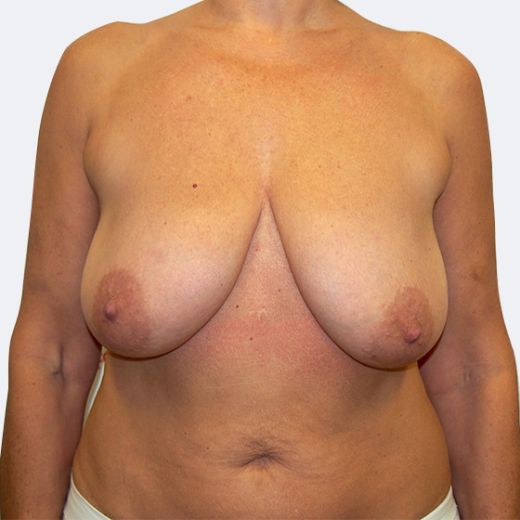 Image before