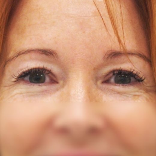 Image before