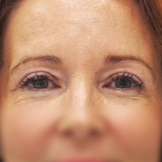 Image after