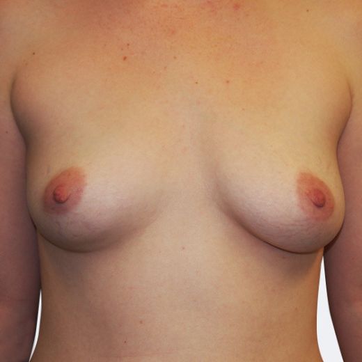 Image before