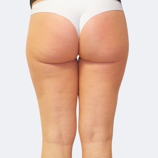 Image after