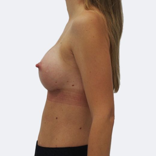 Image after