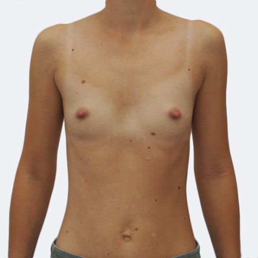 Image before