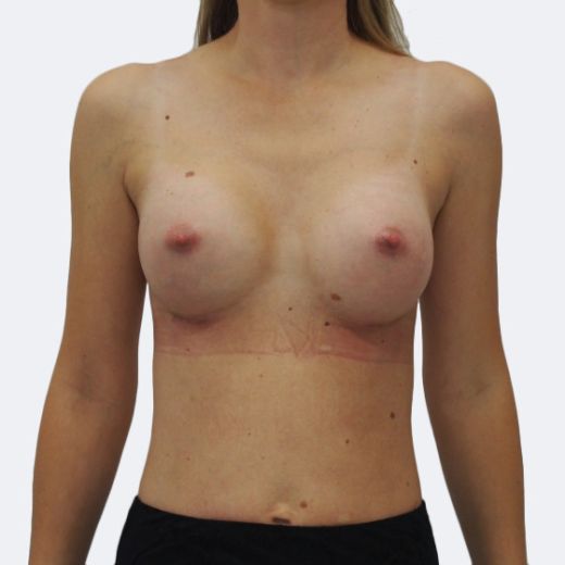 Image after