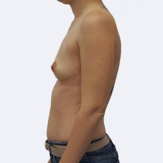 Image before