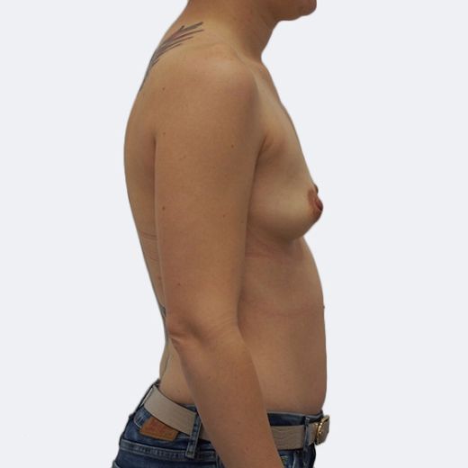 Image before