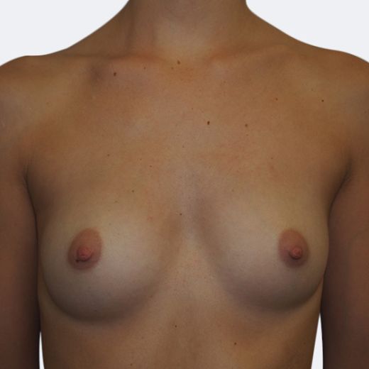 Image before