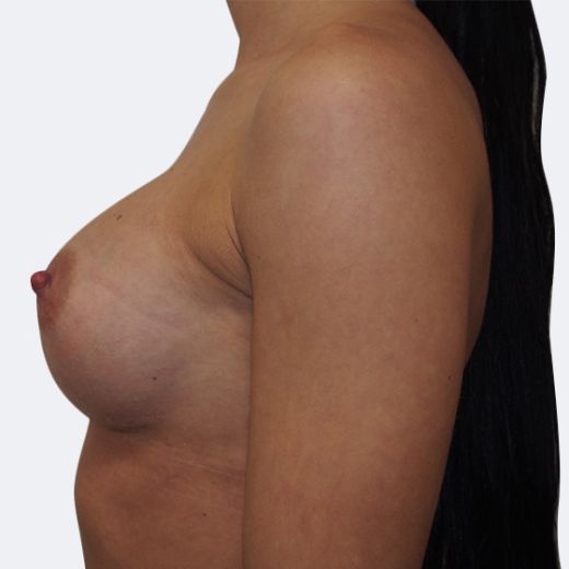 Image after