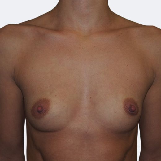 Image before