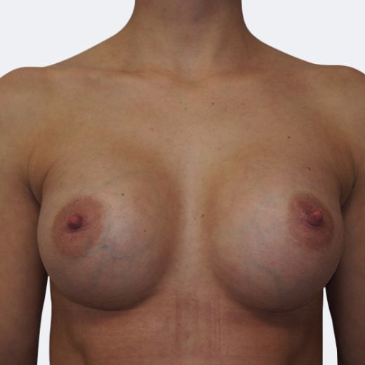Image after