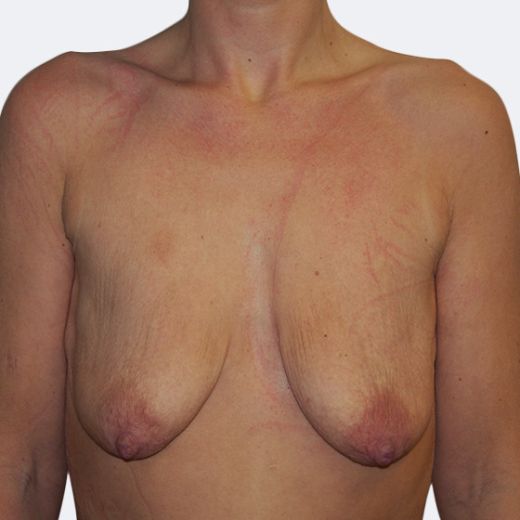 Image before