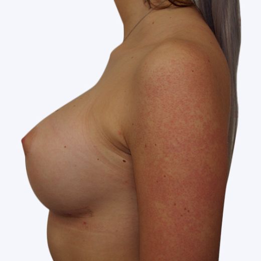 Image after