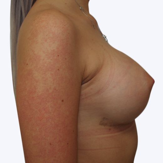 Image after