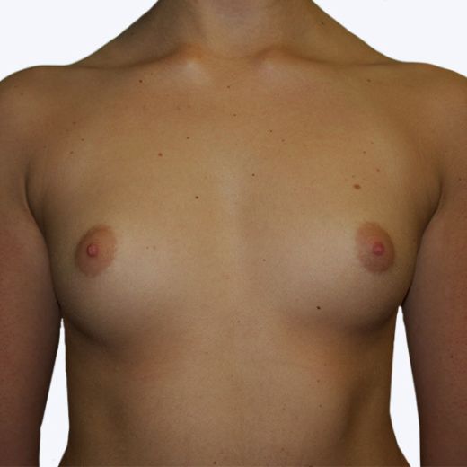 Image before