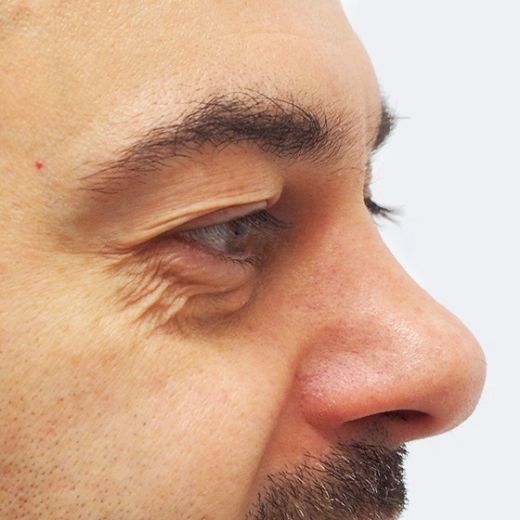 Image before