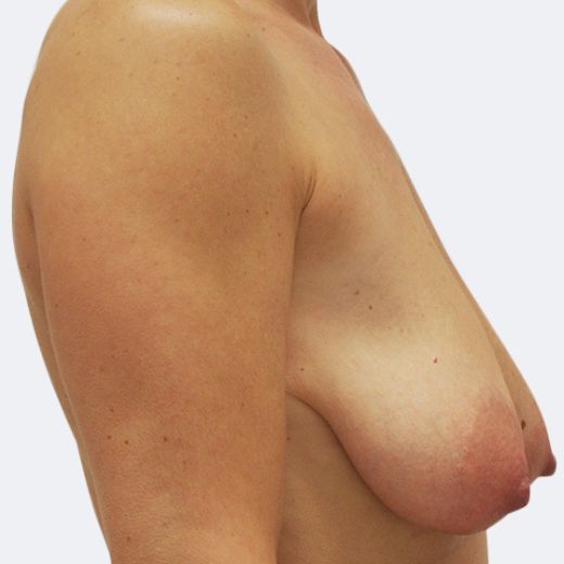 Image before