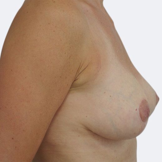 Image after