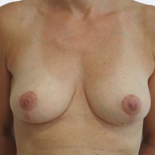 Image after