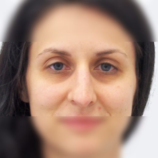 Image before