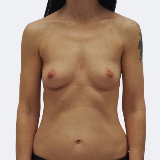 Image before