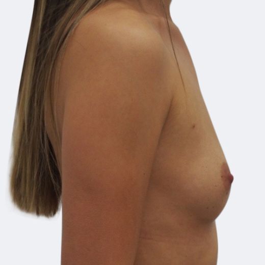 Image before