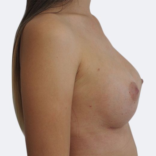 Image after