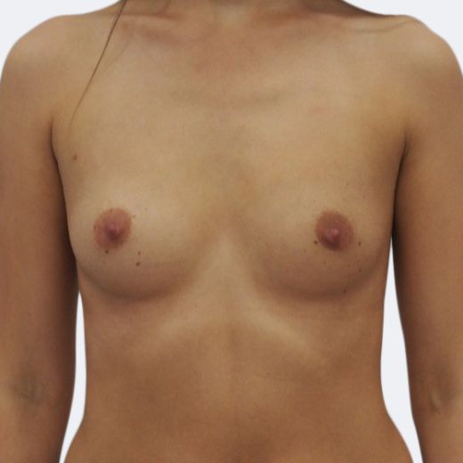 Image before