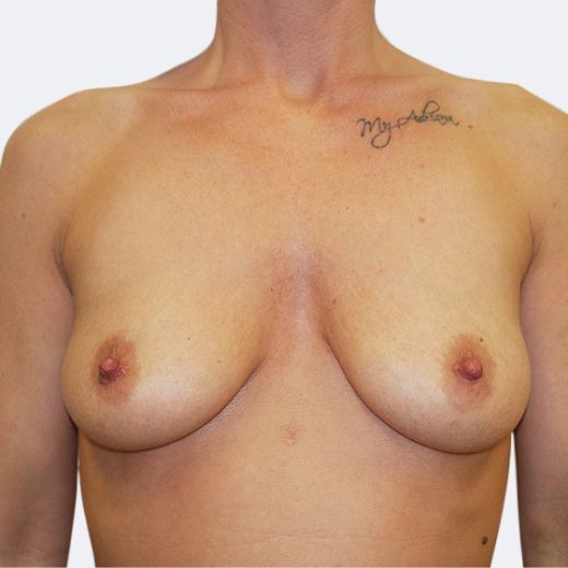 Image before