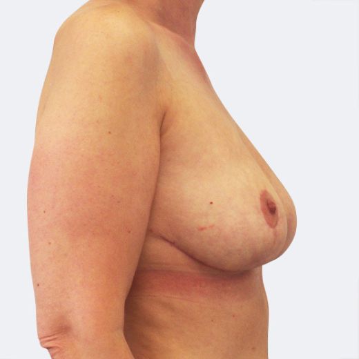Image after