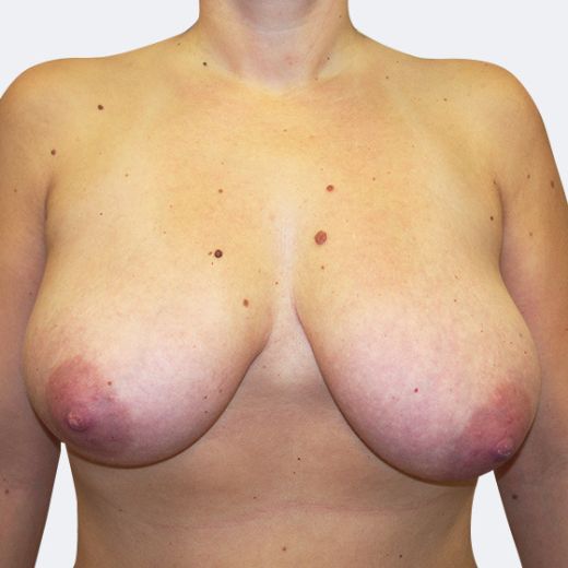 Image before