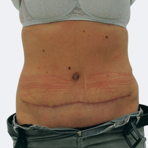 Image after
