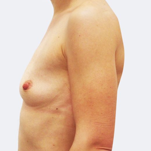 Image before