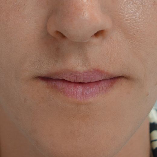 Image before