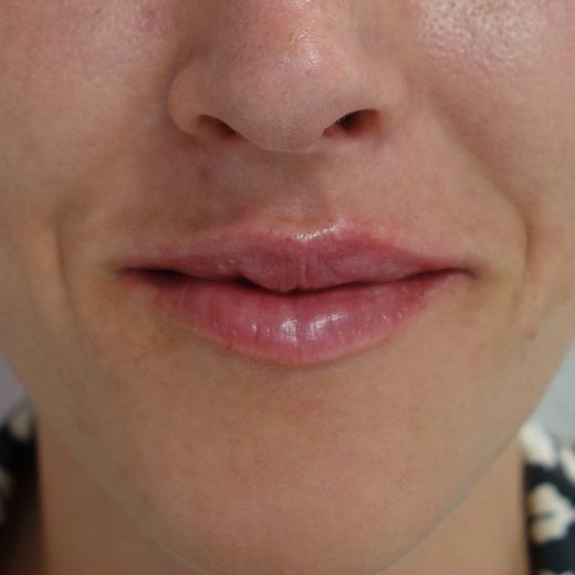 Image after