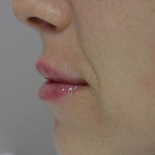 Image after