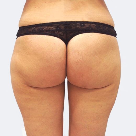 Image before