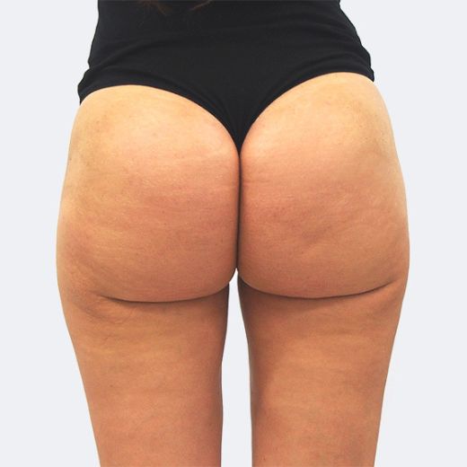 Image after