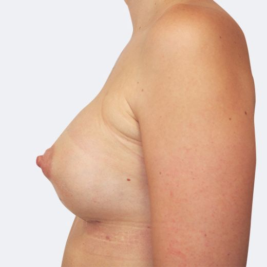 Image after