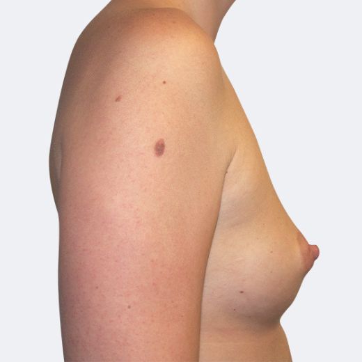 Image before