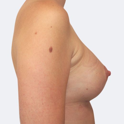 Image after