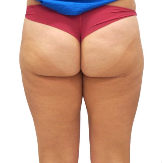 Image after