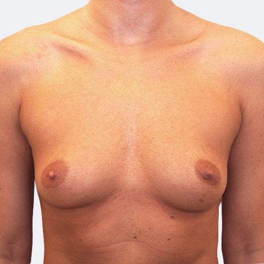 Image before